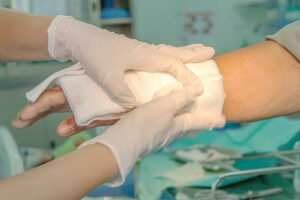 How Goldstein Hayes & Lina, LLC Can Help After a Serious Burn Injury in Atlanta, GA