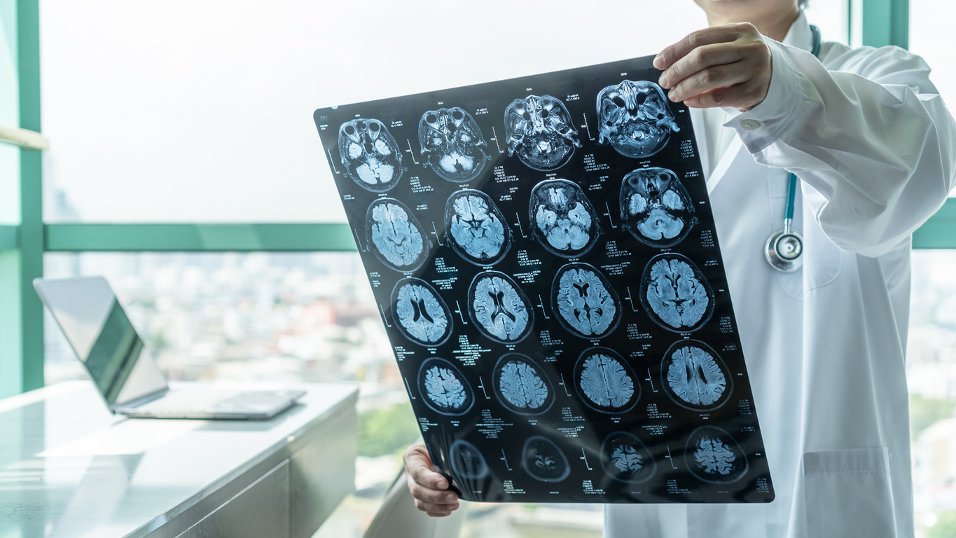 What Is CTE?